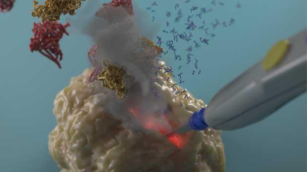 Credit: Jeroen Claus (Phospho Biomedical Animation)