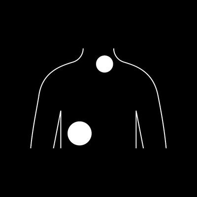 Solid tumours in children image