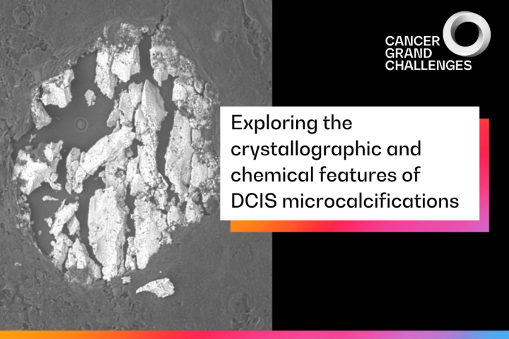 Exploring the crystallographic and chemical features of DCIS microcalcifications